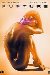 Rupture