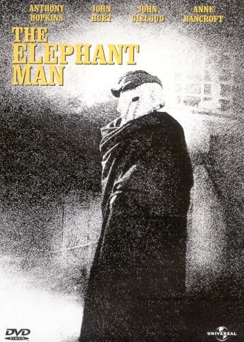 Elephant man, The